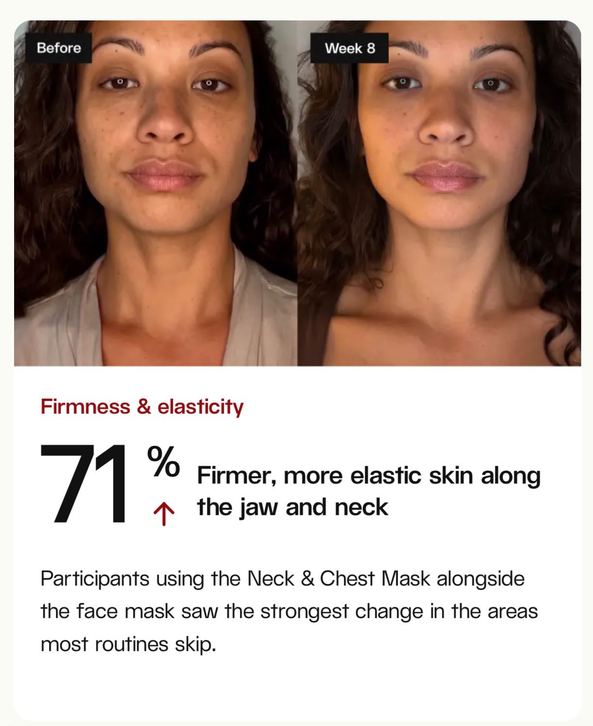 Before and after: 71% firmer skin along the jaw and neck at week 8