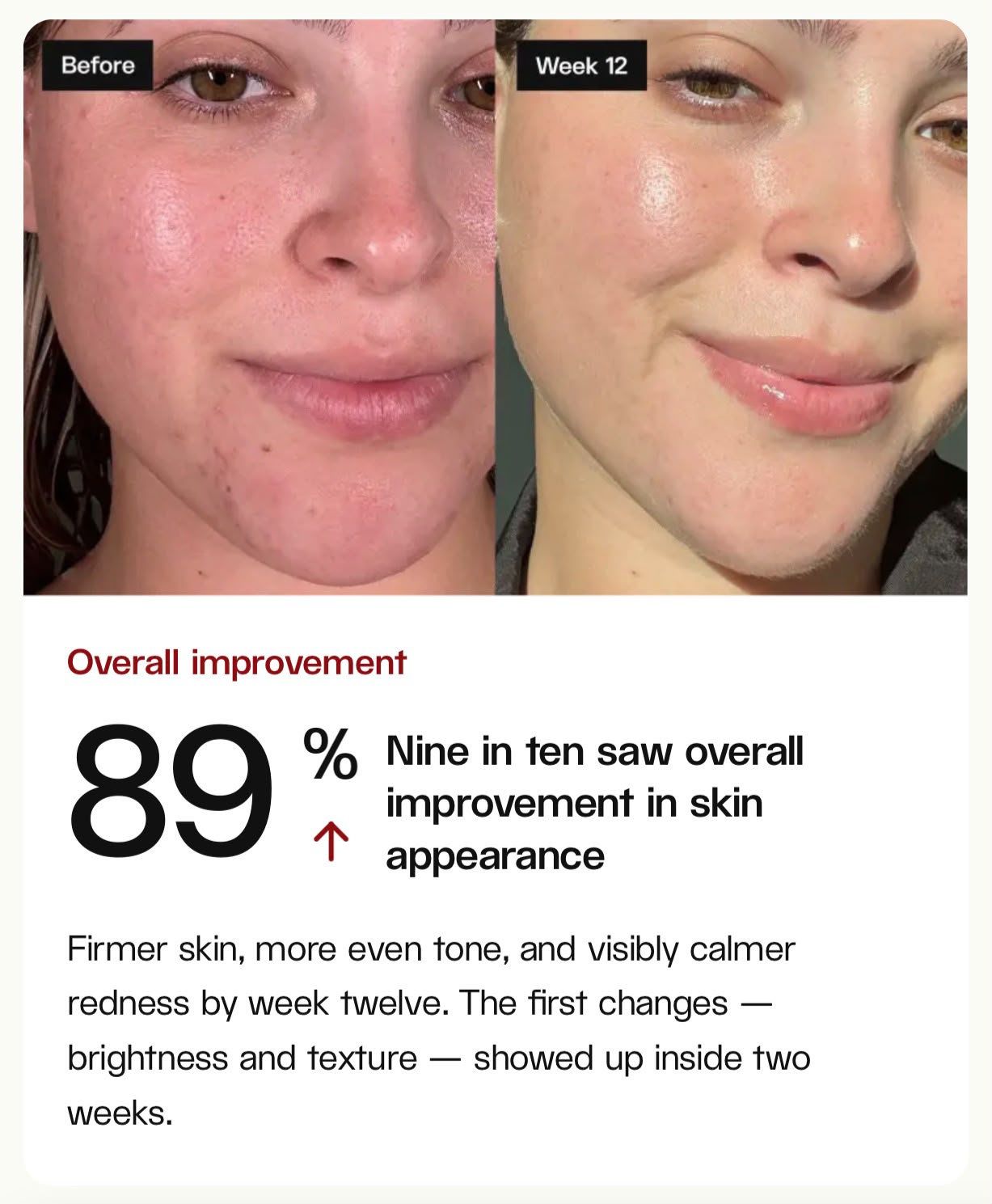 Before and after: 89% overall improvement at week 12